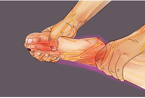 Neuropathy & Nerve Damage? Do This Immediately (Watch)