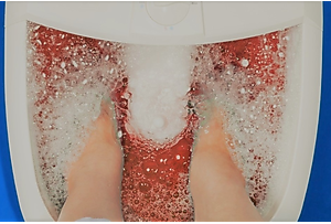 MD: If You Have Toenail Fungus, Do This Immediately (Watch)