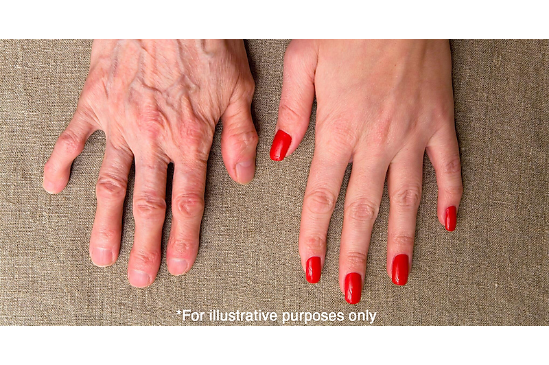 Plastic Surgeon Tells: "Doing This Every Morning Can Snap Back Sagging Skin (No Creams Needed)"