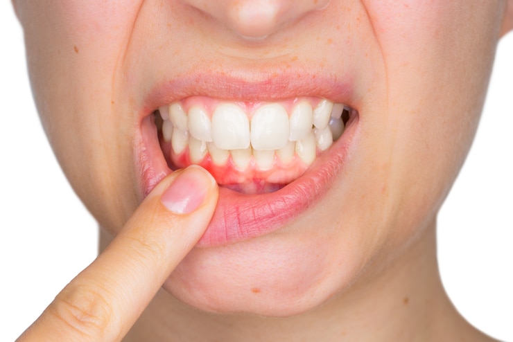 7 tips to help you keep your teeth after 30